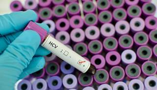 The number of deaths associated with hepatitis C is higher than the total number of deaths resulting from 60 other infectious diseases. The number of deaths associated with hepatitis C is higher than the total number of deaths resulting from 60 other infectious diseases.