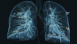 Although COPD is the third leading cause of death in the US, patients often lack access to basic therapies and consistent care. Although COPD is the third leading cause of death in the US, patients often lack access to basic therapies and consistent care.
