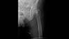 Ortho Dx: Hip pain after a fall Ortho Dx: Hip pain after a fall