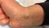 Ortho Dx: A mass on the wrist Ortho Dx: A mass on the wrist