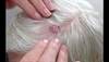 Derm Dx: A lesion on the scalp Derm Dx: A lesion on the scalp