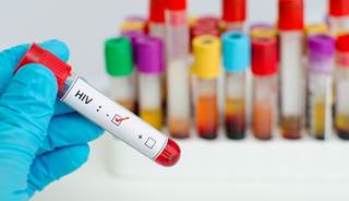 Instances of new HIV infections decreased by 11%. Instances of new HIV infections decreased by 11%.
