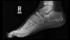 Ortho Dx: Unresolved ankle pain after a sports injury Ortho Dx: Unresolved ankle pain after a sports injury