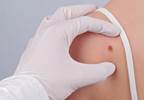 Nonmelanoma Skin Cancer Risk Up in Organ Transplant Recipients Nonmelanoma Skin Cancer Risk Up in Organ Transplant Recipients