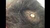 Derm Dx: A nodule on the scalp since childhood Derm Dx: A nodule on the scalp since childhood