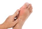 Gaps exist in clinician knowledge of gout management Gaps exist in clinician knowledge of gout management