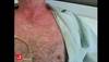 Image of the Week: How would you manage this drug-induced reaction? Image of the Week: How would you manage this drug-induced reaction?