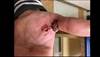 Ortho Dx: Flexor tendon injury Ortho Dx: Flexor tendon injury