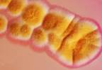 Managing aspergillosis: updated guidelines from IDSA Managing aspergillosis: updated guidelines from IDSA