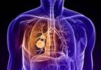 Risk-Based vs USPSTF Criteria for Lung Cancer Screening Risk-Based vs USPSTF Criteria for Lung Cancer Screening