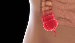 Older adults presenting with abdominal pain should be screened for appendicitis. Older adults presenting with abdominal pain should be screened for appendicitis.