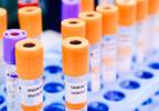 FDA approves new HPV test FDA approves new HPV test