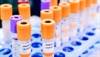 FDA approves new HPV test FDA approves new HPV test