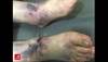 Image of the Week: When a snake strikes twice Image of the Week: When a snake strikes twice