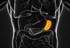 A case of G6PD deficiency A case of G6PD deficiency