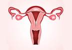 Abnormal uterine bleeding linked to hematologic malignancies Abnormal uterine bleeding linked to hematologic malignancies