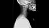 Ortho Dx: Which nerve root is being compressed in this patient? Ortho Dx: Which nerve root is being compressed in this patient?