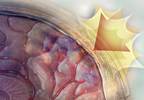 Managing concussion in primary care Managing concussion in primary care