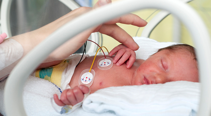 Preventing bronchopulmonary dysplasia in preterm infants 