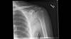 Ortho Dx: Shoulder pain and stiffness Ortho Dx: Shoulder pain and stiffness