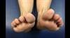 Ortho Dx: Leg length discrepancy after total hip replacement Ortho Dx: Leg length discrepancy after total hip replacement