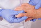 Age as a determining factor in TNFi discontinuation in rheumatoid arthritis Age as a determining factor in TNFi discontinuation in rheumatoid arthritis
