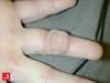 Image of the Week: Uncommon presentation or uncommon disease? Image of the Week: Uncommon presentation or uncommon disease?