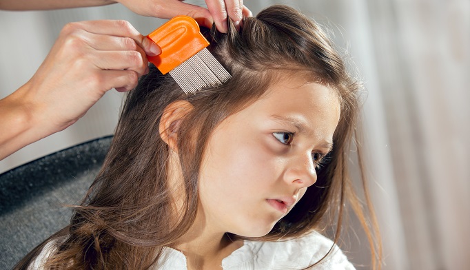 prescription-treatments-are-more-effective-in-head-lice-treatment-the