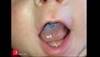 Image of the Week: Baby with a blue tongue Image of the Week: Baby with a blue tongue