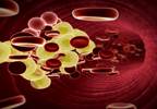 Alternative non-statin therapies effectively lower LDL cholesterol Alternative non-statin therapies effectively lower LDL cholesterol