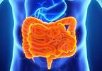 Immune profile differs during symptom flare for patients with irritable bowel syndrome Immune profile differs during symptom flare for patients with irritable bowel syndrome