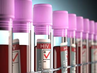At the end of 2014, approximately 85% of individuals with HIV were aware of their infection; the goal by 2020 is 90%. At the end of 2014, approximately 85% of individuals with HIV were aware of their infection; the goal by 2020 is 90%.