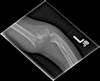 Ortho Dx: A child is injured after a fall from a tree Ortho Dx: A child is injured after a fall from a tree