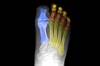 Diabetic peripheral neuropathy: an overview Diabetic peripheral neuropathy: an overview