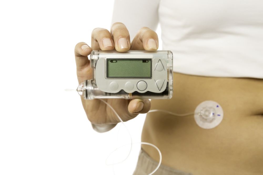 insulin pump diabetes control center patients