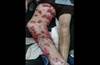 Image of the Week: A dramatic cutaneous presentation Image of the Week: A dramatic cutaneous presentation