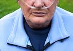 Proposing new concepts and definitions in COPD Proposing new concepts and definitions in COPD