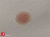 Image of the Week: A clinical clue appears at the bedside Image of the Week: A clinical clue appears at the bedside