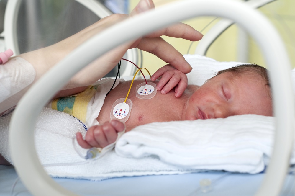 neonatal-abstinence-syndrome-increases-among-rural-born-infants-the