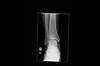 Ortho Dx: A man with years of ankle pain Ortho Dx: A man with years of ankle pain
