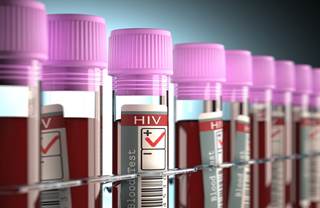 The HIV-positive population of the United Kingdom has a higher risk of death than the general population, despite availability of free treatment and care. The HIV-positive population of the United Kingdom has a higher risk of death than the general population, despite availability of free treatment and care.