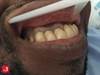 Image of the Week: A heavy metal emergency Image of the Week: A heavy metal emergency