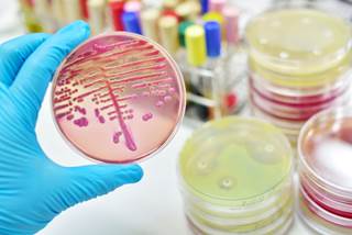 Updated international guidelines for sepsis and septic shock emphasize frequent patient re-evaluation and patient-specific tailoring of hemodynamic therapy. Updated international guidelines for sepsis and septic shock emphasize frequent patient re-evaluation and patient-specific tailoring of hemodynamic therapy.