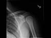 Ortho Dx: Can you see the radiographic finding that indicates the diagnosis? Ortho Dx: Can you see the radiographic finding that indicates the diagnosis?