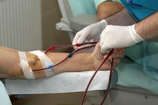 Depression is common in patients receiving chronic hemodialysis but seems to be ineffectively treated. Depression is common in patients receiving chronic hemodialysis but seems to be ineffectively treated.