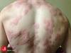 Image of the Week: Hunting for deer and a diagnosis Image of the Week: Hunting for deer and a diagnosis