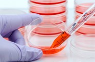 Stem Cell Therapy May Be Effective For Multiple Sclerosis The Clinical Advisor