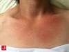 Image of the Week: Which neurotransmitter is the cause of these symptoms? Image of the Week: Which neurotransmitter is the cause of these symptoms?