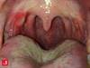 Image of the Week: What's the cause of these lesions and vision loss? Image of the Week: What's the cause of these lesions and vision loss?