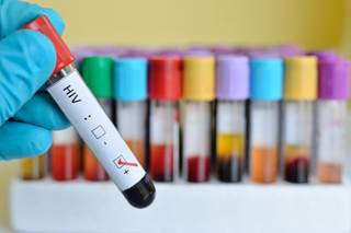 The annual number of perinatal HIV-infected infants born in the United States decreased from 2002 to 2013. The annual number of perinatal HIV-infected infants born in the United States decreased from 2002 to 2013.